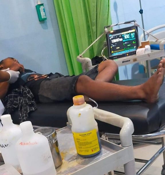 Geng Motor Beraksi di Pantai Labu, Lukai Seorang Remaja