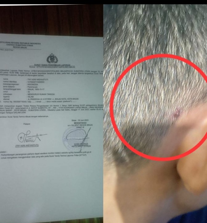 Seorang Napi di Lapas Klas IIA Binjai Diduga Dianiaya Sesama Tahanan