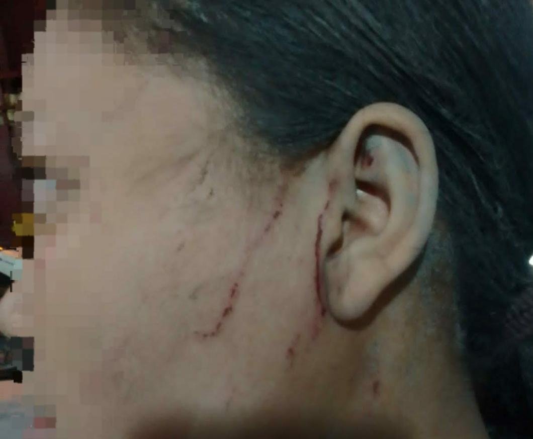 Dikeroyok, Siswi SMP di Belawan Luka Luka, Pelaku: Kami Gak Bisa Ditangkap !