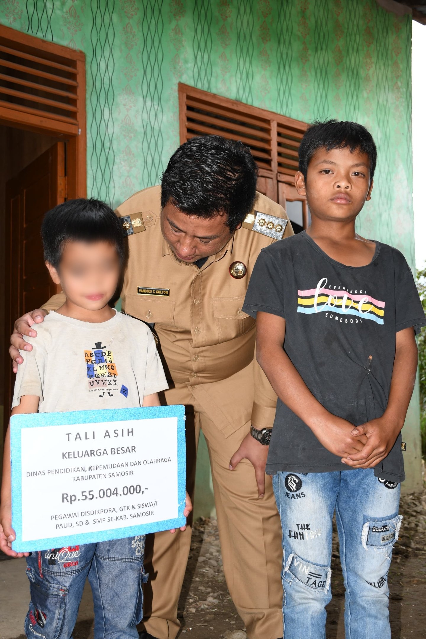 Bupati Samosir Bantu Anak Penderita Kanker Mata