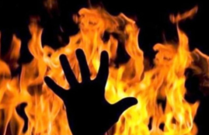 Diduga Sakit Hati, Wanita Paruh Baya Dibakar, Pelaku Diburon