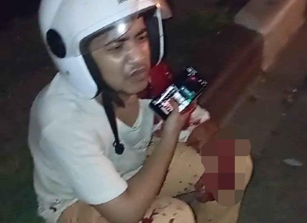 Tangan Waiters Nyaris Putus, Dibacok Begal di Jalan Tuasan