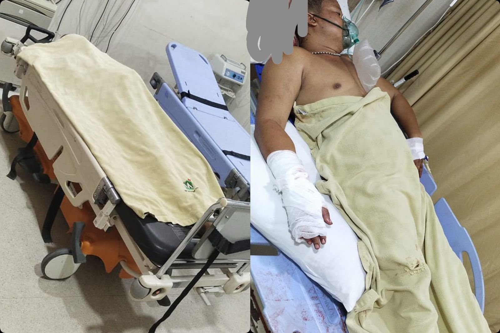 Dua Warga Tewas dan 6 Lainnya Luka-Luka, Buntut Kericuhan di Selambo