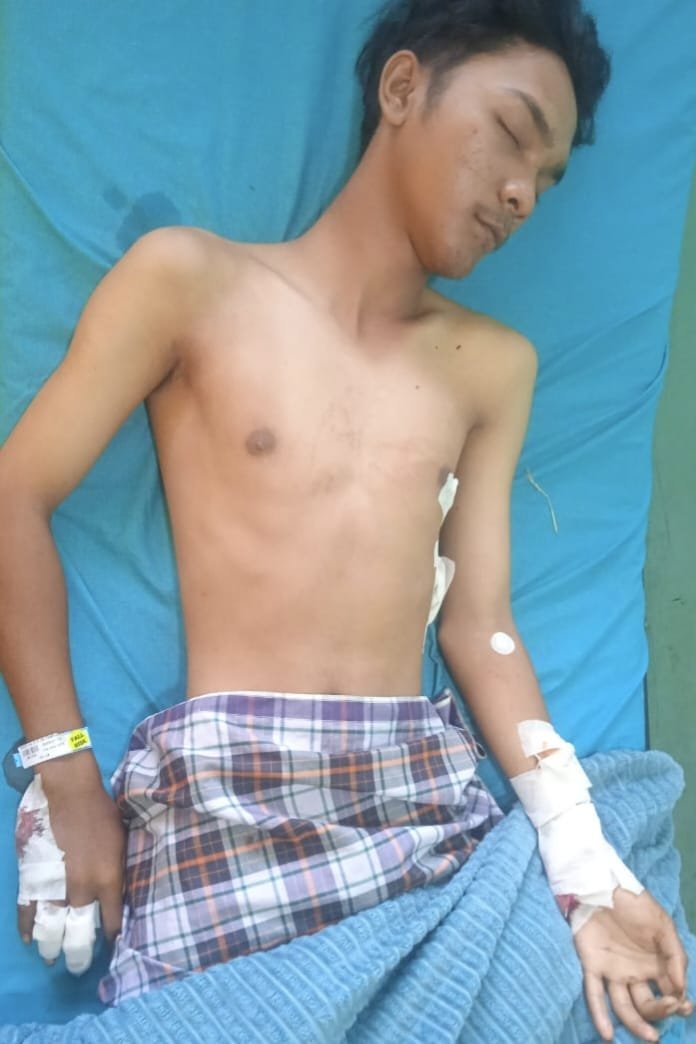 Ngeri! Begal Bersenpi dan Bersajam Berkeliaran di Jalan Sultan Serdang, Tangan Anak Medan Nyaris Putus