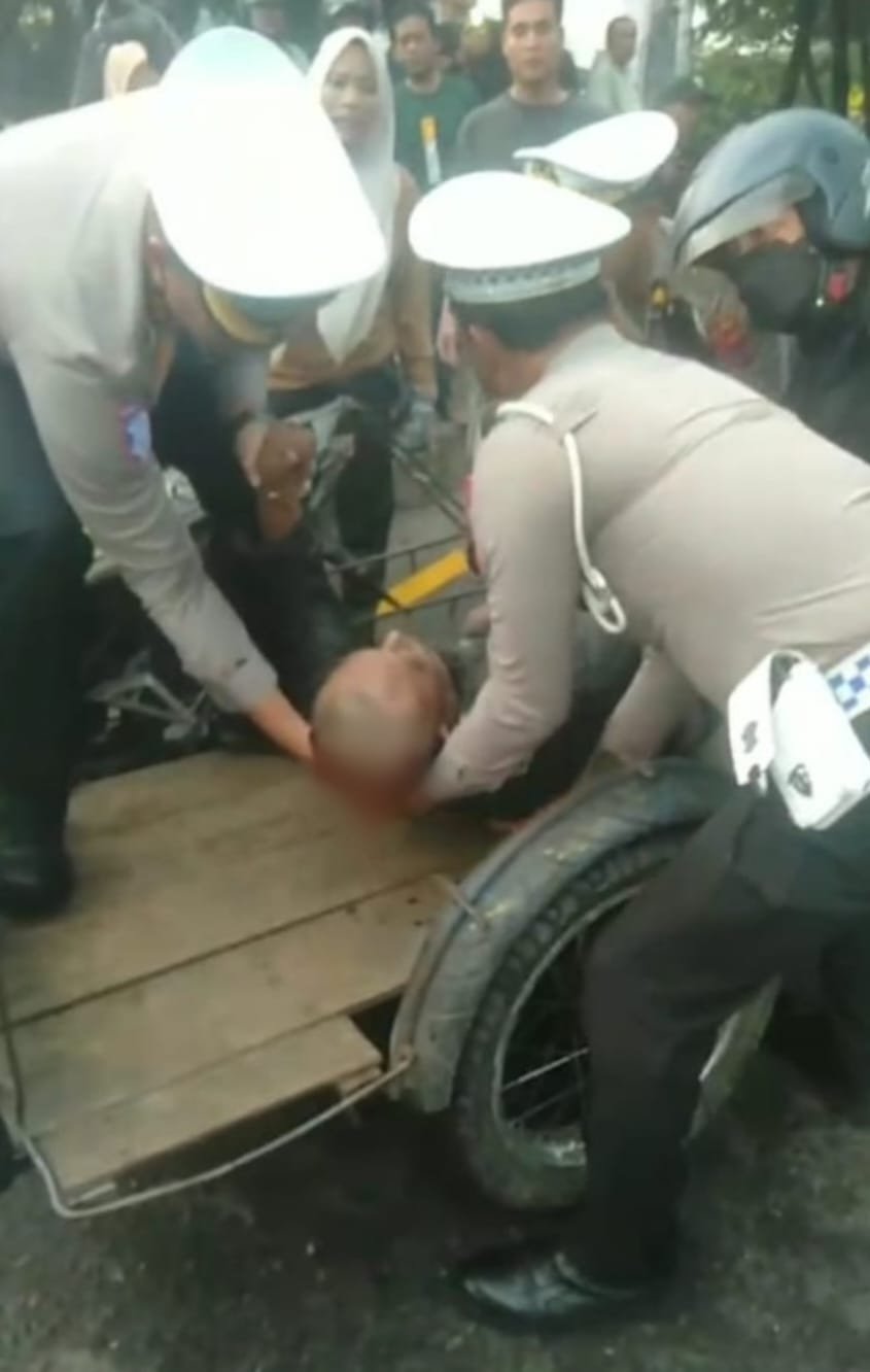 Warga Perbaungan Kritis Diduga Korban Tabrak Lari