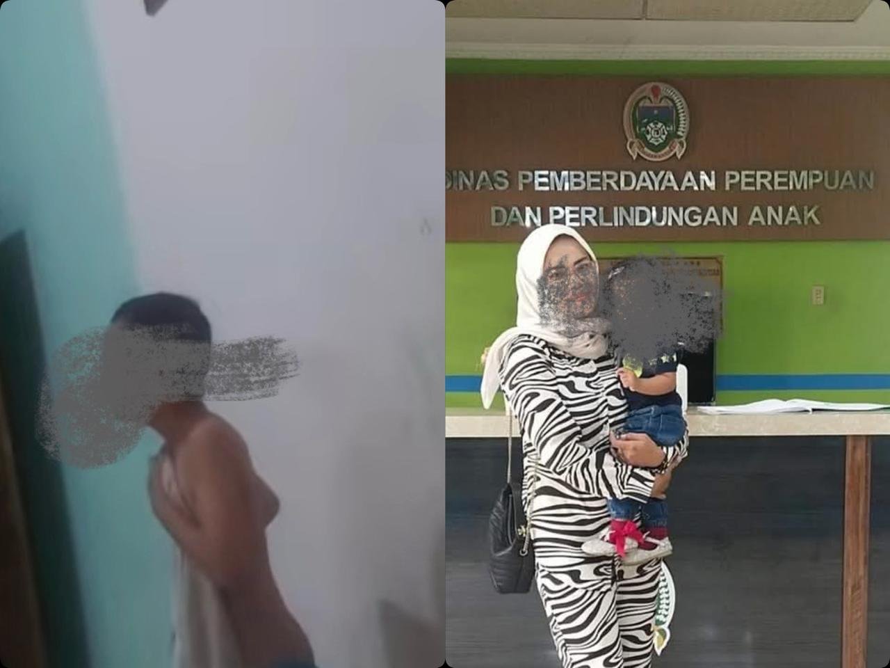 Miris! Ibu Tiri Berstatus ASN Diduga Siram Anak 10 Tahun dengan Air Panas