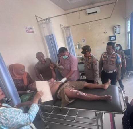 Tukang Bangunan di Langkat Tersengat Arus Listrik, Paha dan Tangan Melepuh