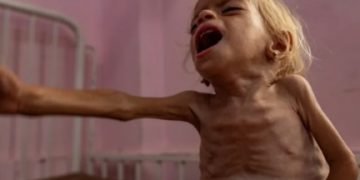 UNRWA: Israel Biang Kelaparan di Gaza, Dunia Harus Bertindak