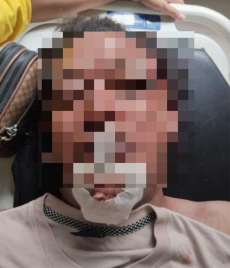 Polisi Masih Dalami Penyebab Tewasnya Wartawan Nico Saragih, Keluarga Tolak Otopsi