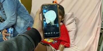 Tak Dapat Klaim BPJS Kesehatan, RSUD Pirngadi Tetap Tangani Korban Peluru Nyasar Tawuran di Belawan