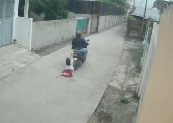 Aksi Nekat Bocah 9 Tahun Cegah Pencurian Berujung Luka