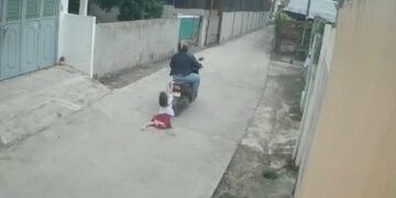 Aksi Nekat Bocah 9 Tahun Cegah Pencurian Berujung Luka