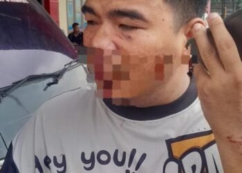 Diduga Tanpa Pemicu, Warga Patumbak Alami Penganiayaan Gunakan Helm