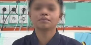 Dirawat di RS Haji Medan, Kondisi Siswa Keracunan MBG Membaik